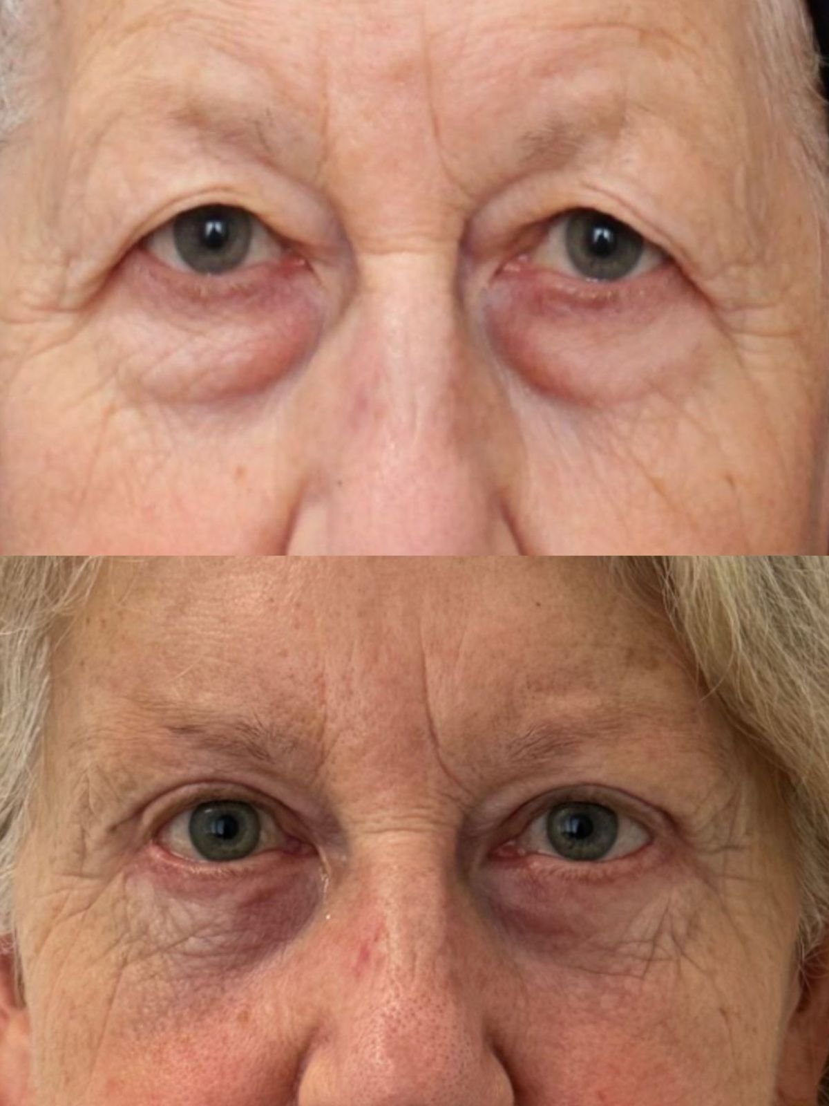 WhatsApp Image 2026-02-23 at 11.23.40